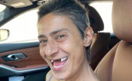 Yıldız Tilbe, dişsiz fotoğraflarını paylaştı