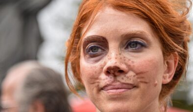 Antalya’da hayvanseverlerden sokak köpeği düzenlemesine karşı protesto